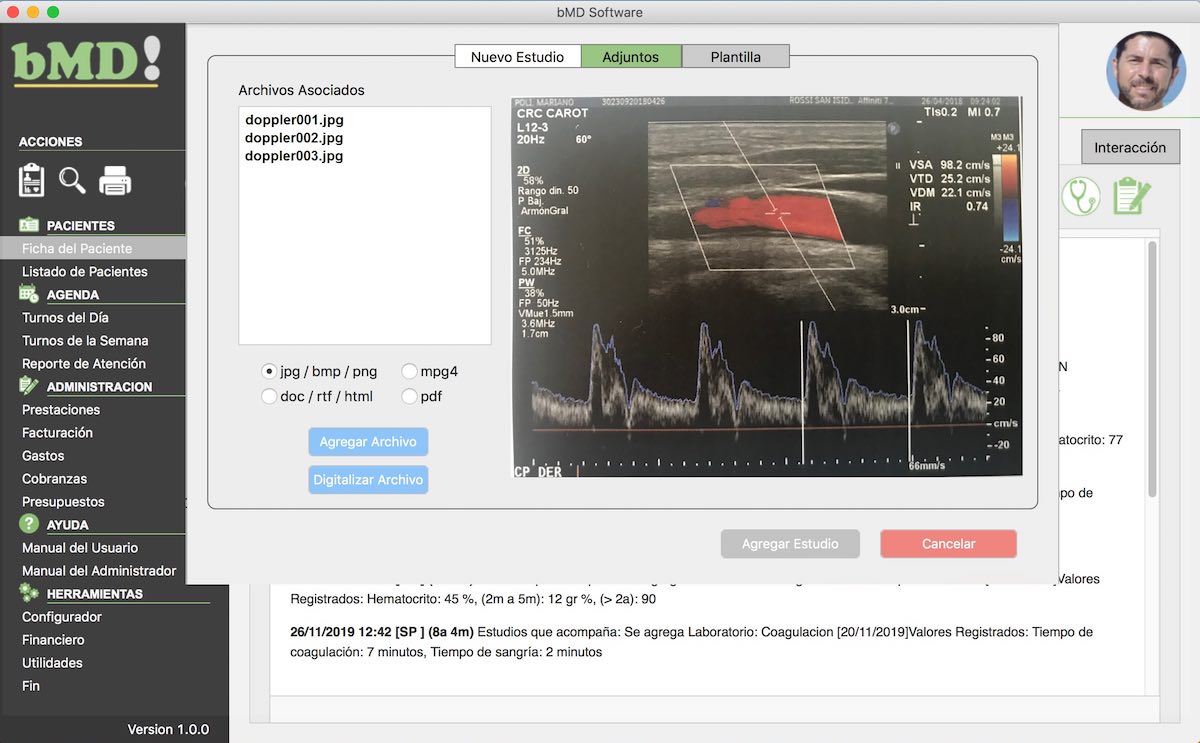 BMD Software - Screenshot 2